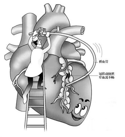 超聲骨密度測試儀